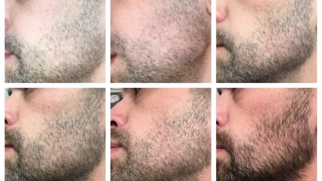 Сыворотка для роста бороды Beard Growth: заказ, цены в Алматы, цены в ...