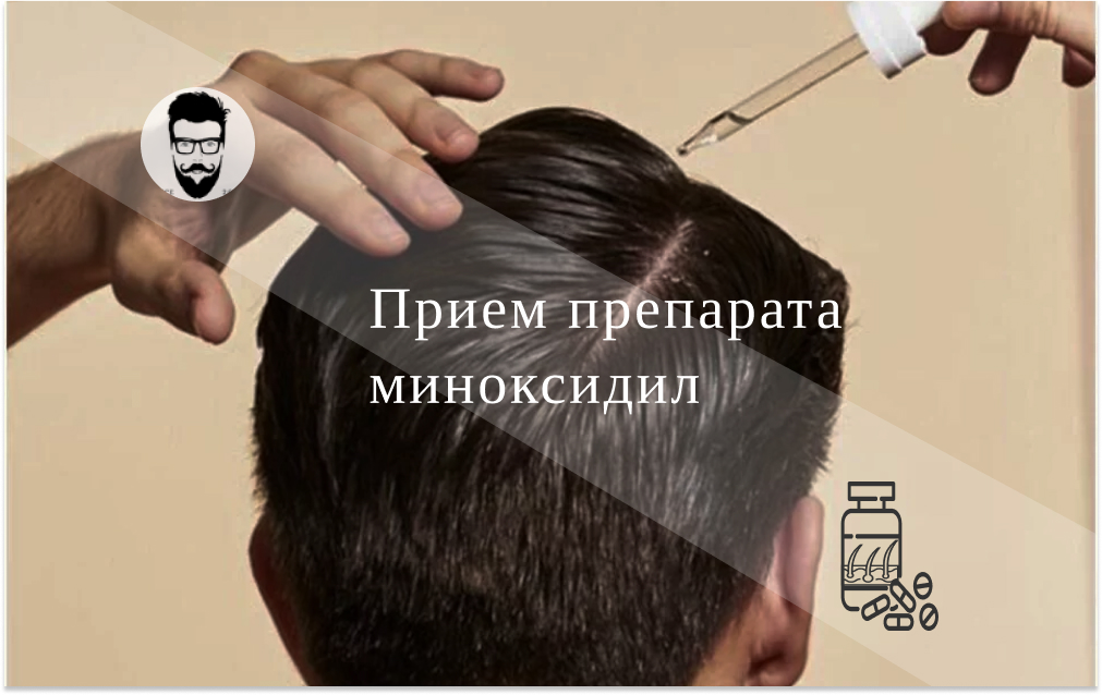Миноксидил для волос?: инструкция по применению