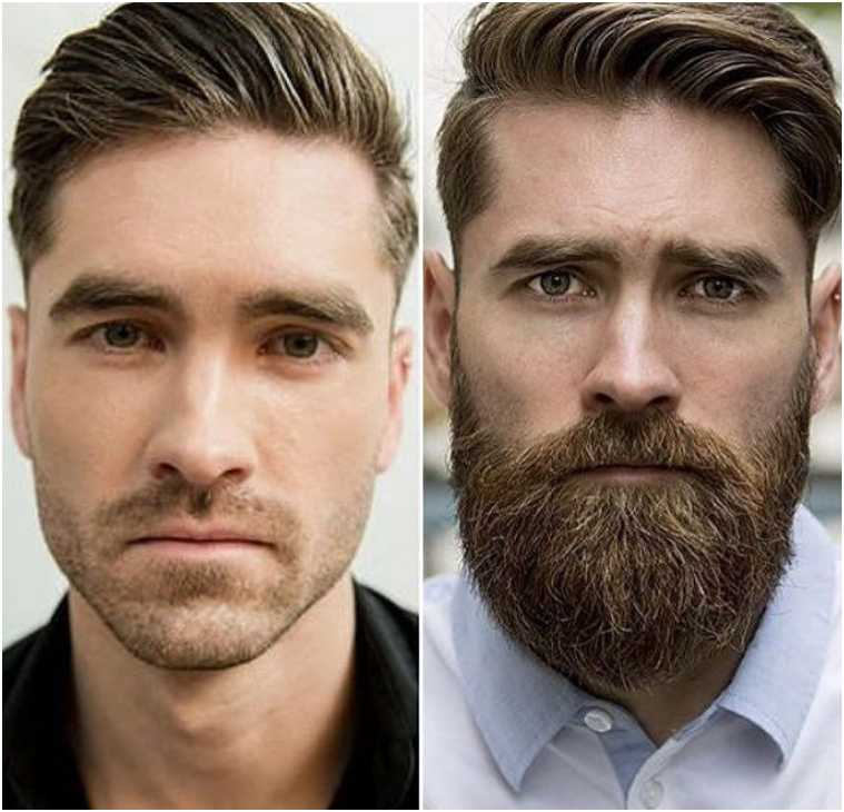 ᐉ Почему не растет борода на щеках • Как заставить расти бороду